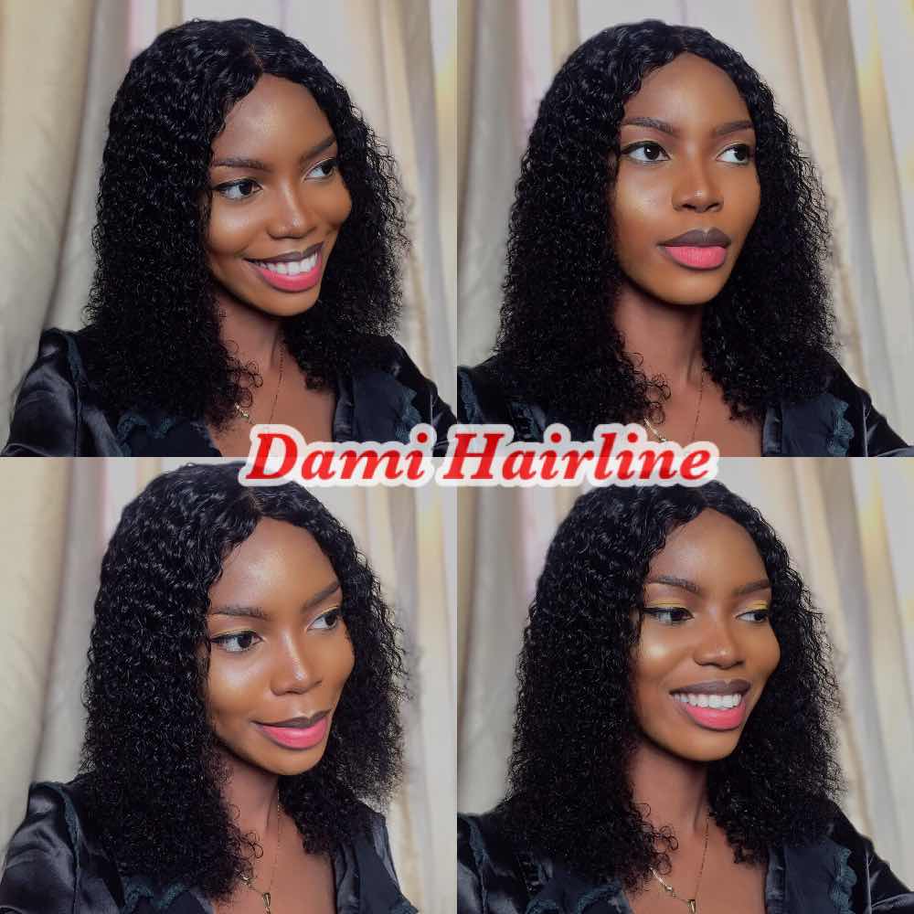 Dami hairline