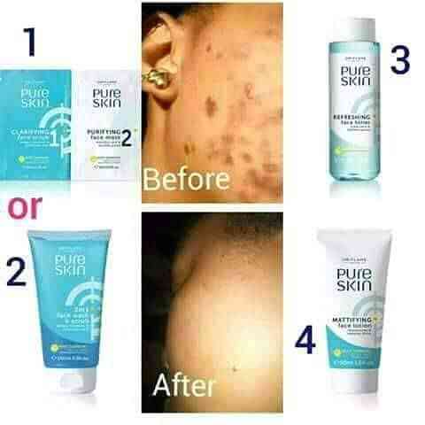 Tremzy skincare